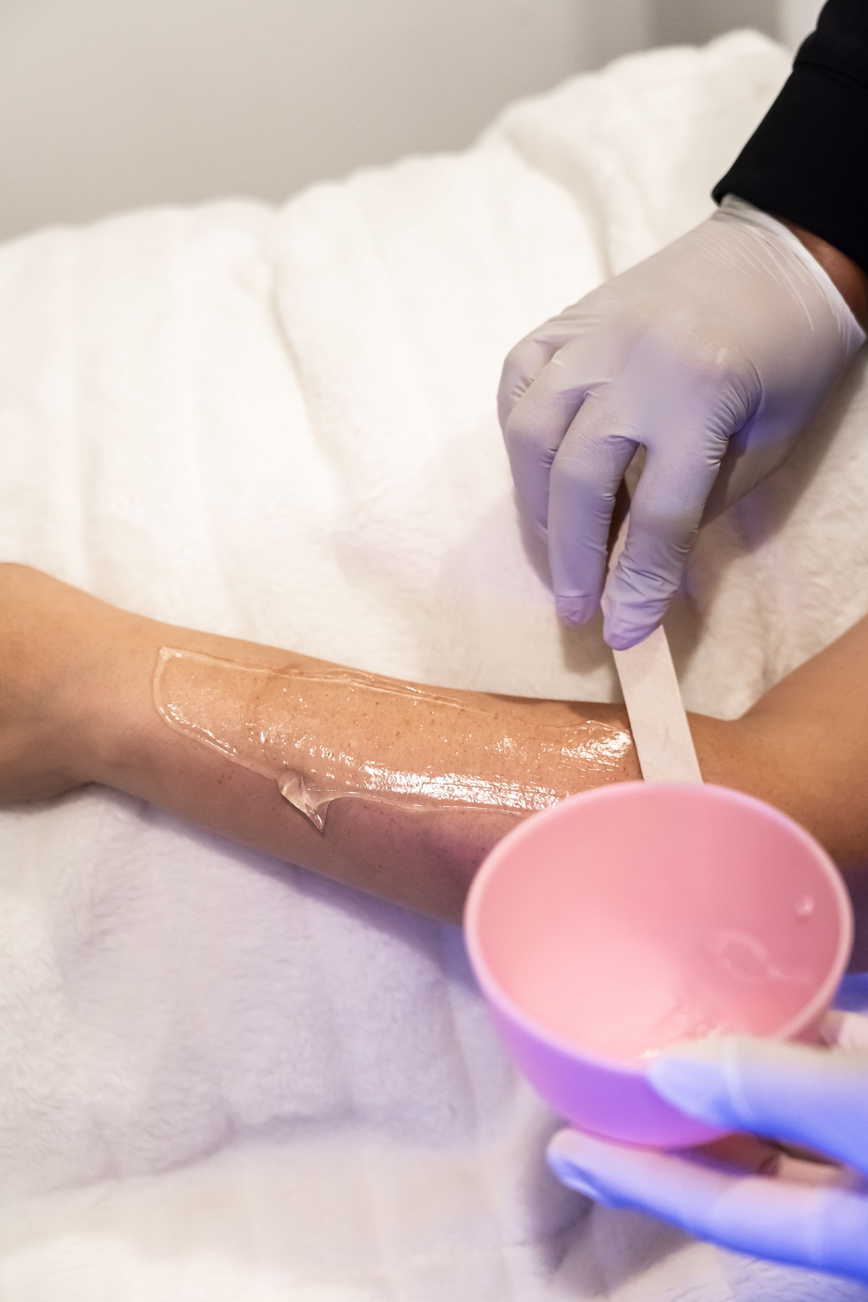 Scar Reduction & Acne Scar Treatments