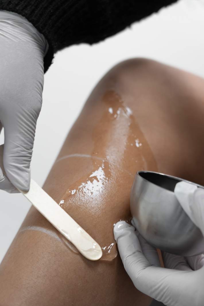 IPL Laser Hair Removal