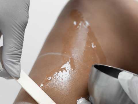 IPL Laser Hair Removal