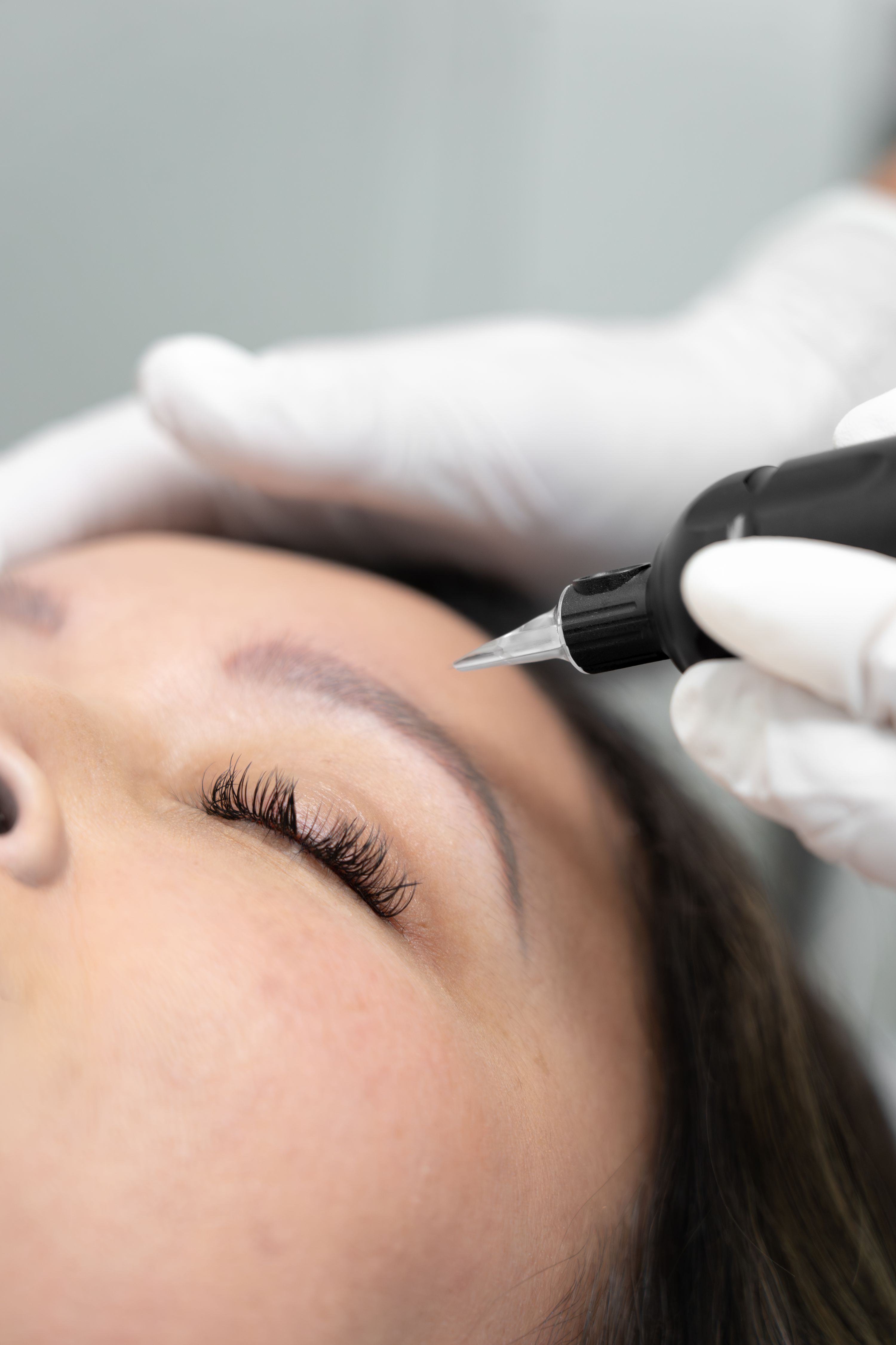 Brow Activation Therapy